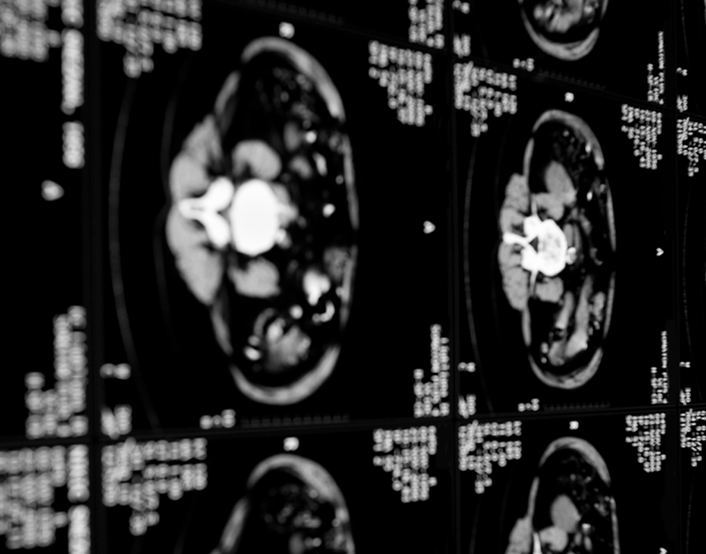 abdominal-ct-scan-708x556-2x