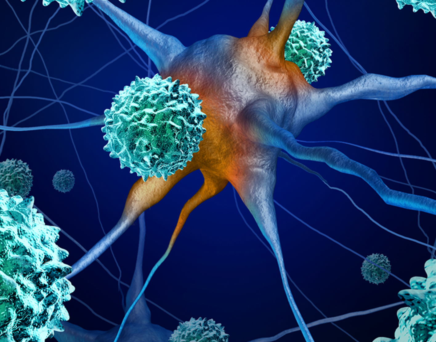 acute-flaccid-myelitis-708x556-2x