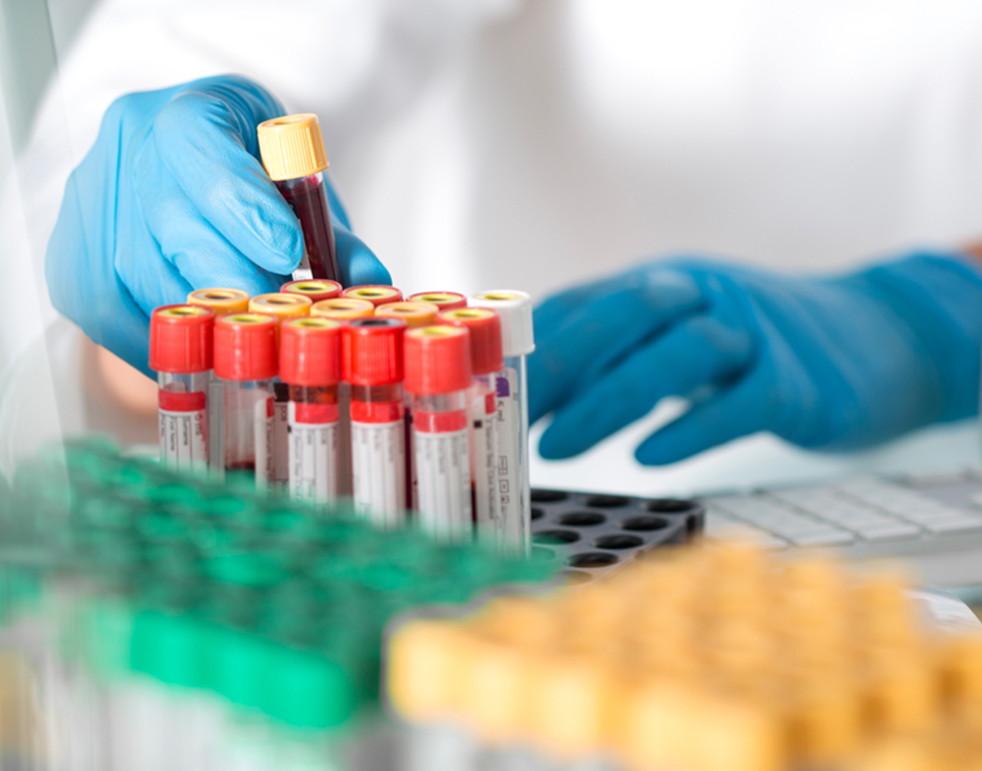 alp-isoenzyme-test-708x556-2x