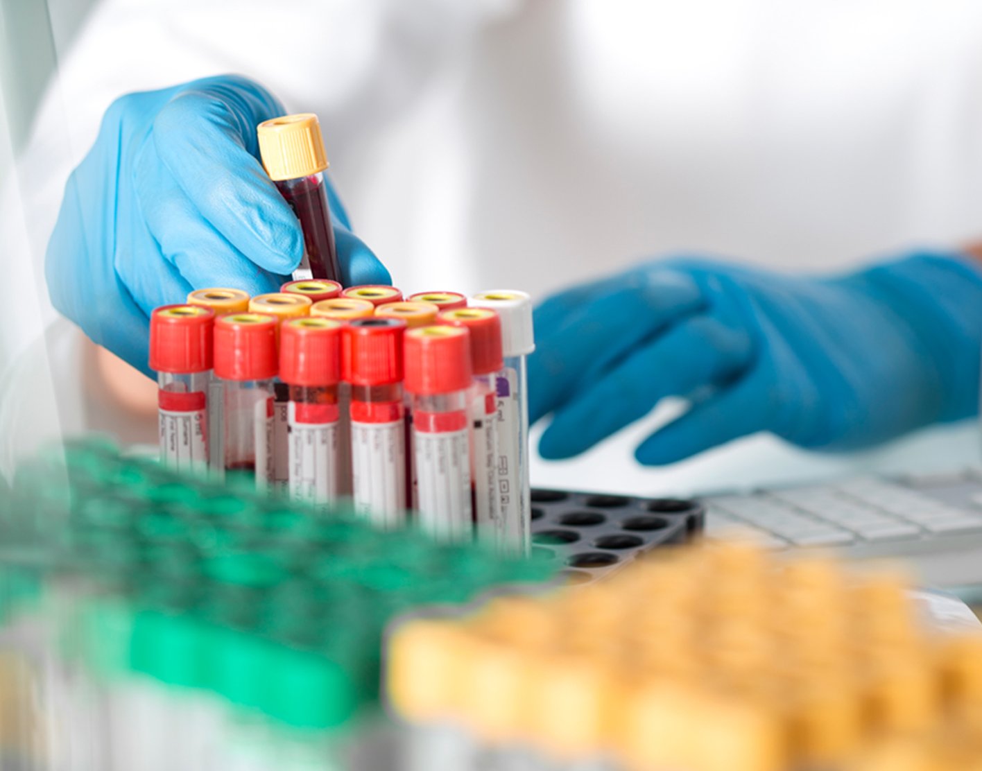 alp-isoenzyme-test-708x556-2x