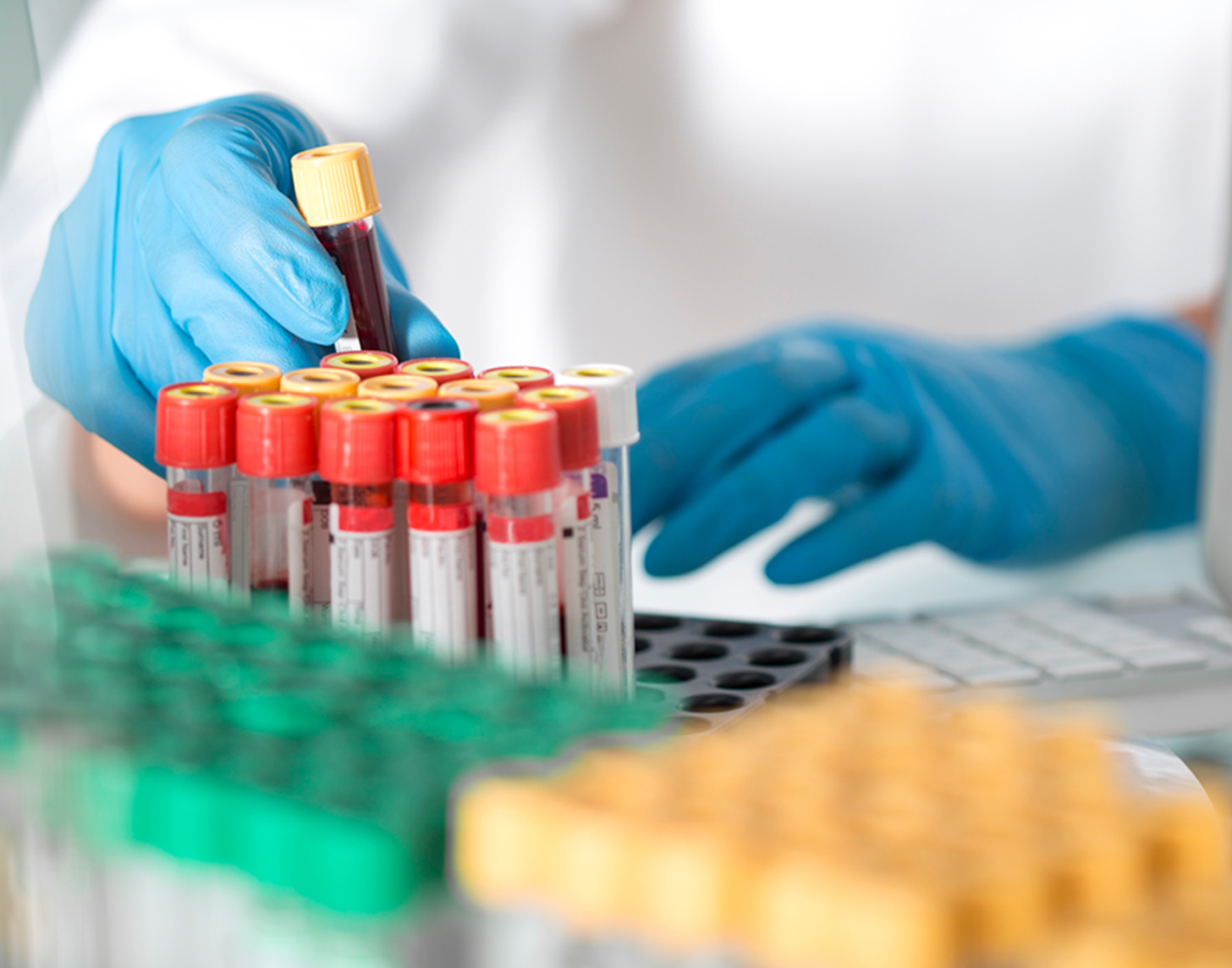 ammonia-blood-test-708x556-2x