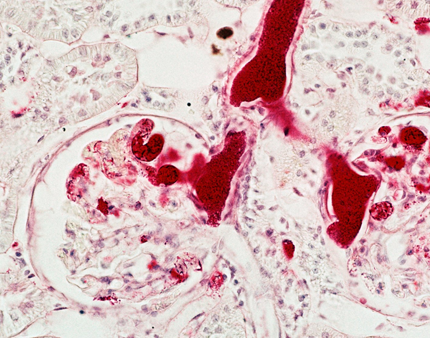 anti-glomerular-basement-membrane-blood-test-708x556-2x