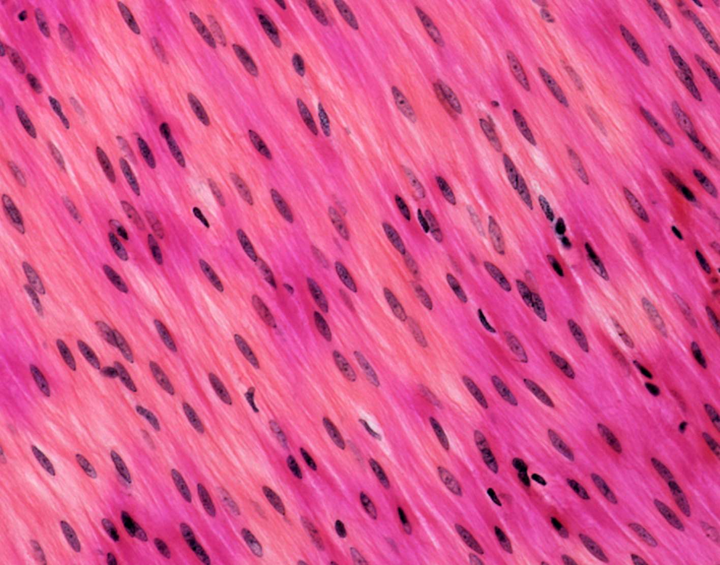 anti-smooth-muscle-antibody-708x556-2x