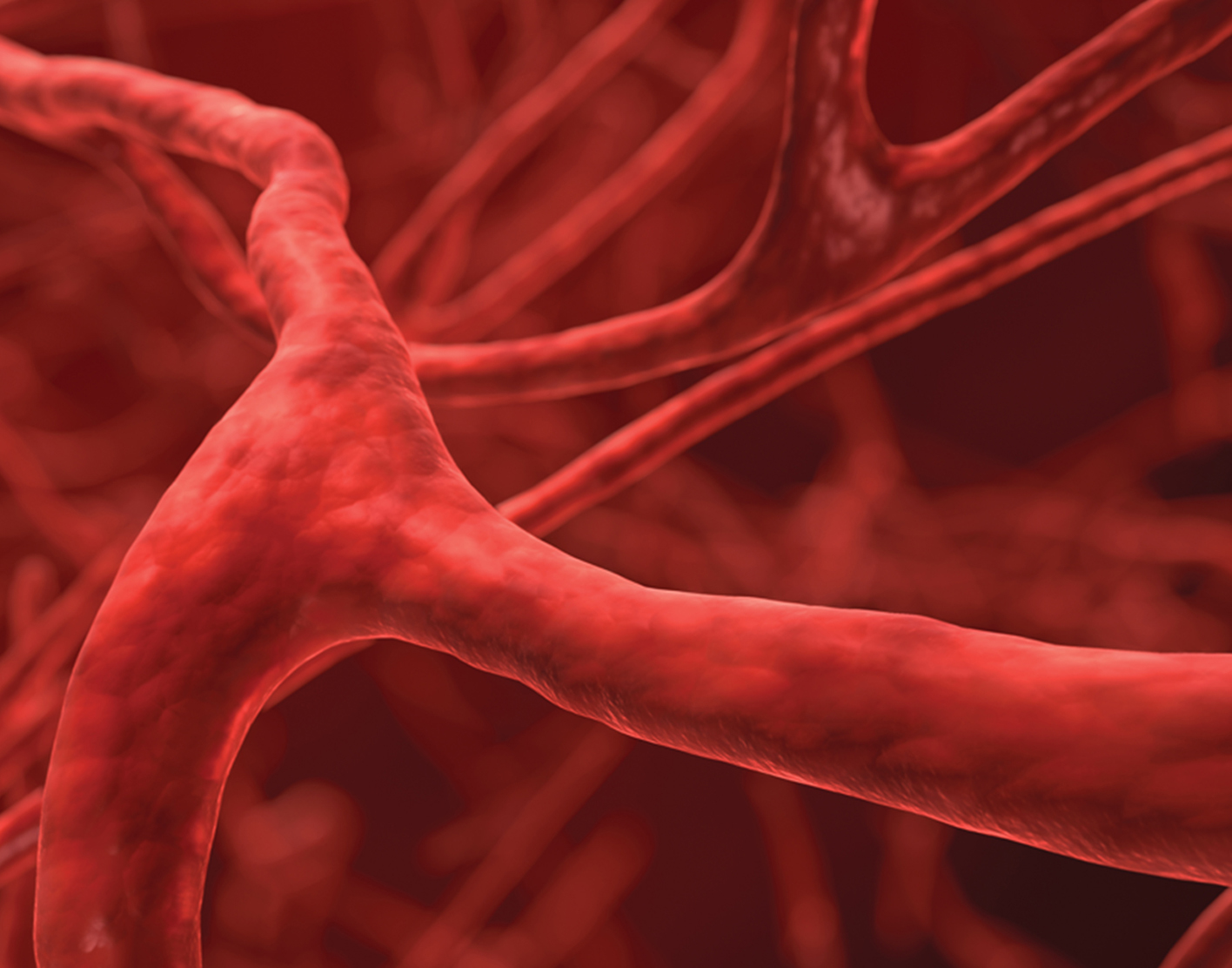 arteriogram-708x556-2x