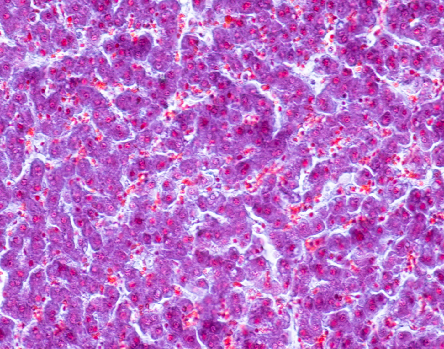 autoimmune-liver-disease-panel-708x556-2x