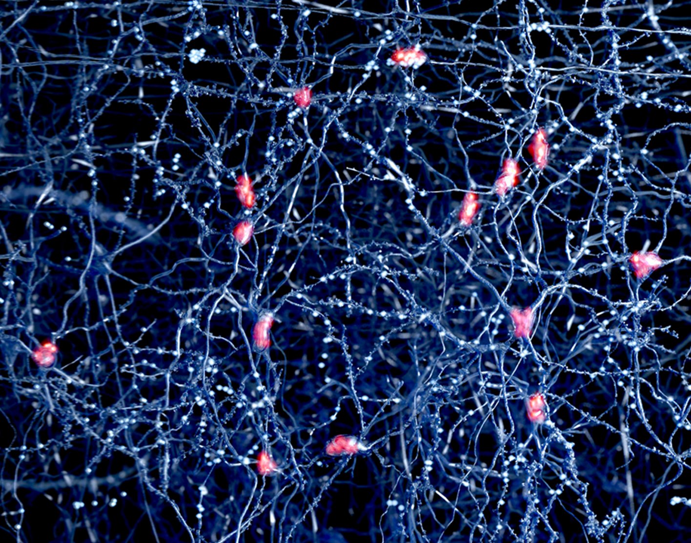 baer-brainstem-auditory-evoked-response-708x556-2x
