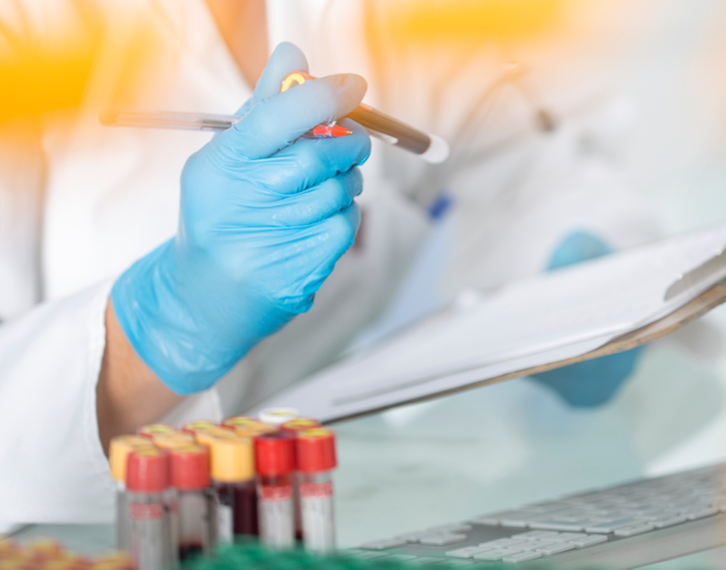 Betacarotene blood test