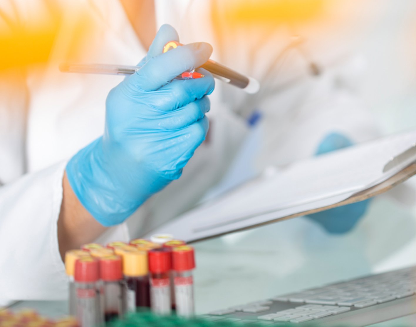 bilirubin-blood-test-708x556-2x