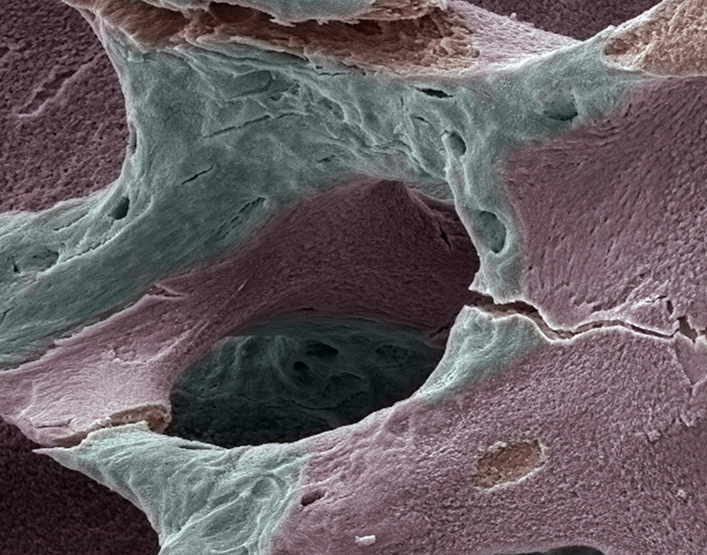 bone-mineral-density-test-708x556-2x