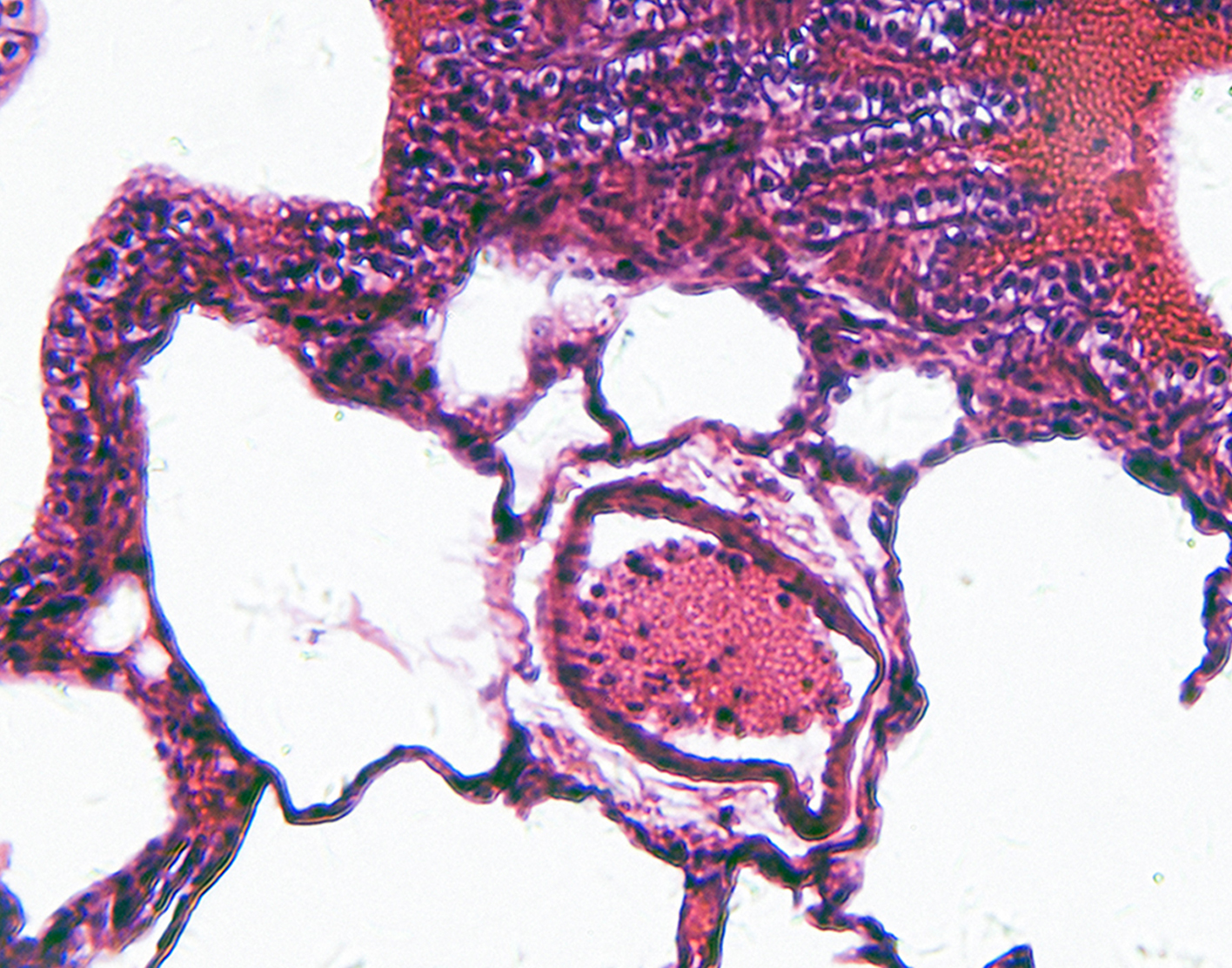 bronchoscopic-culture-708x556-2x