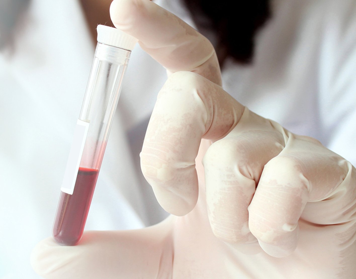 c-reactive-protein-708x556-2x