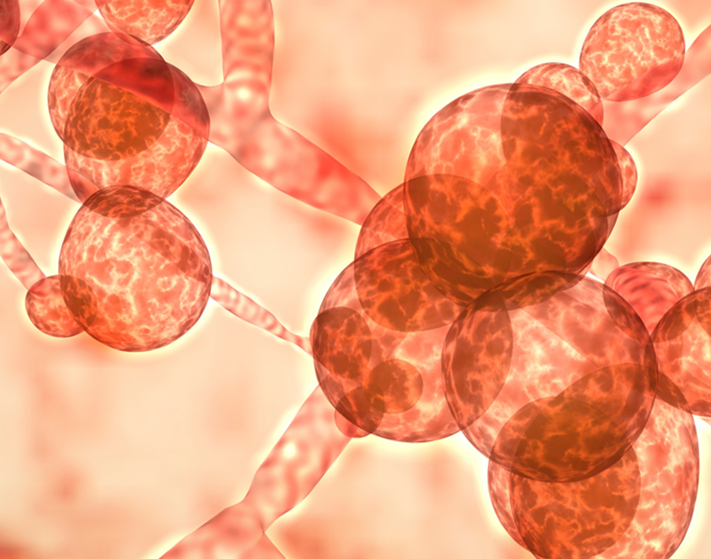 candida-auris-infection-708x556-2x
