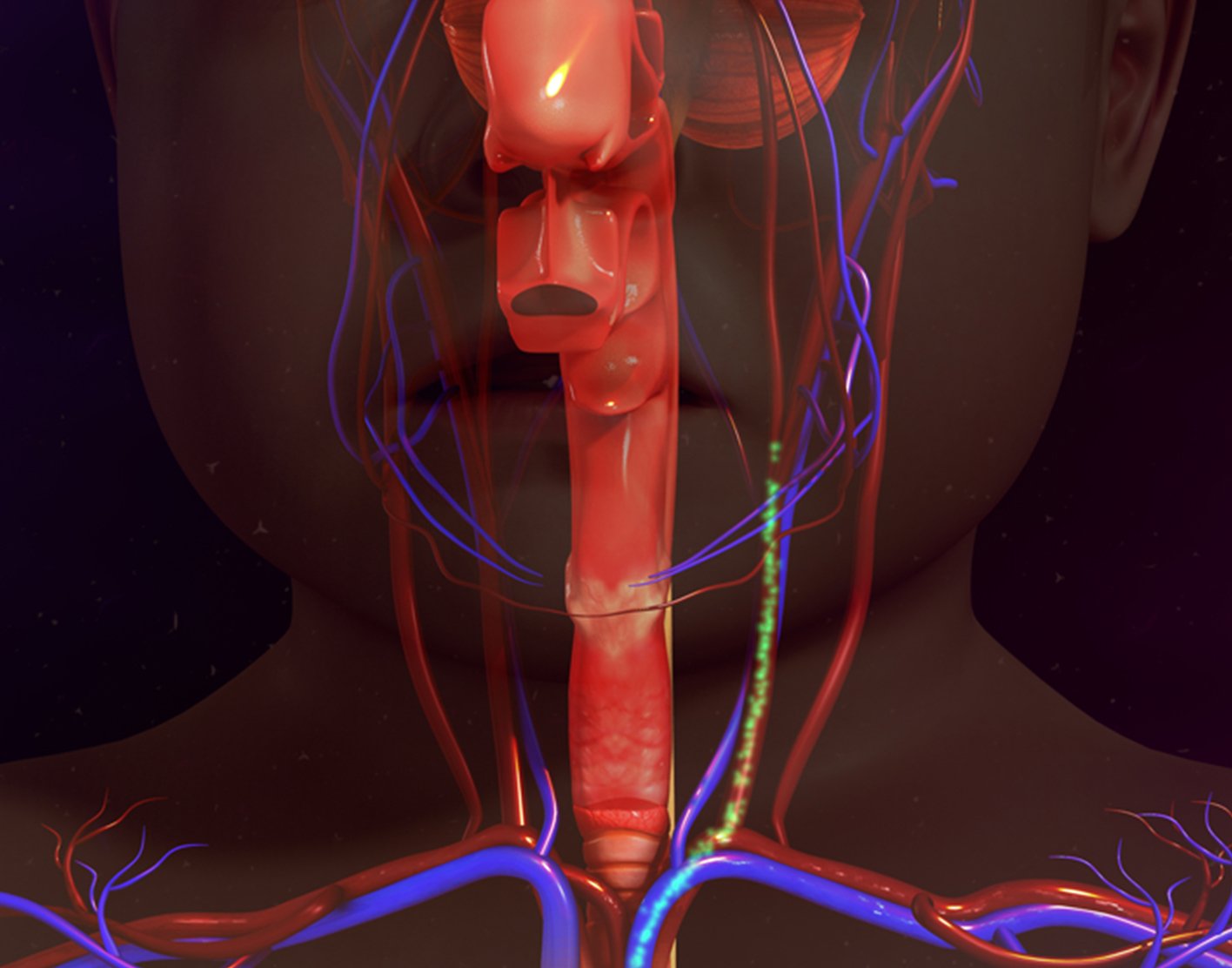 carotid-duplex-708x556-2x