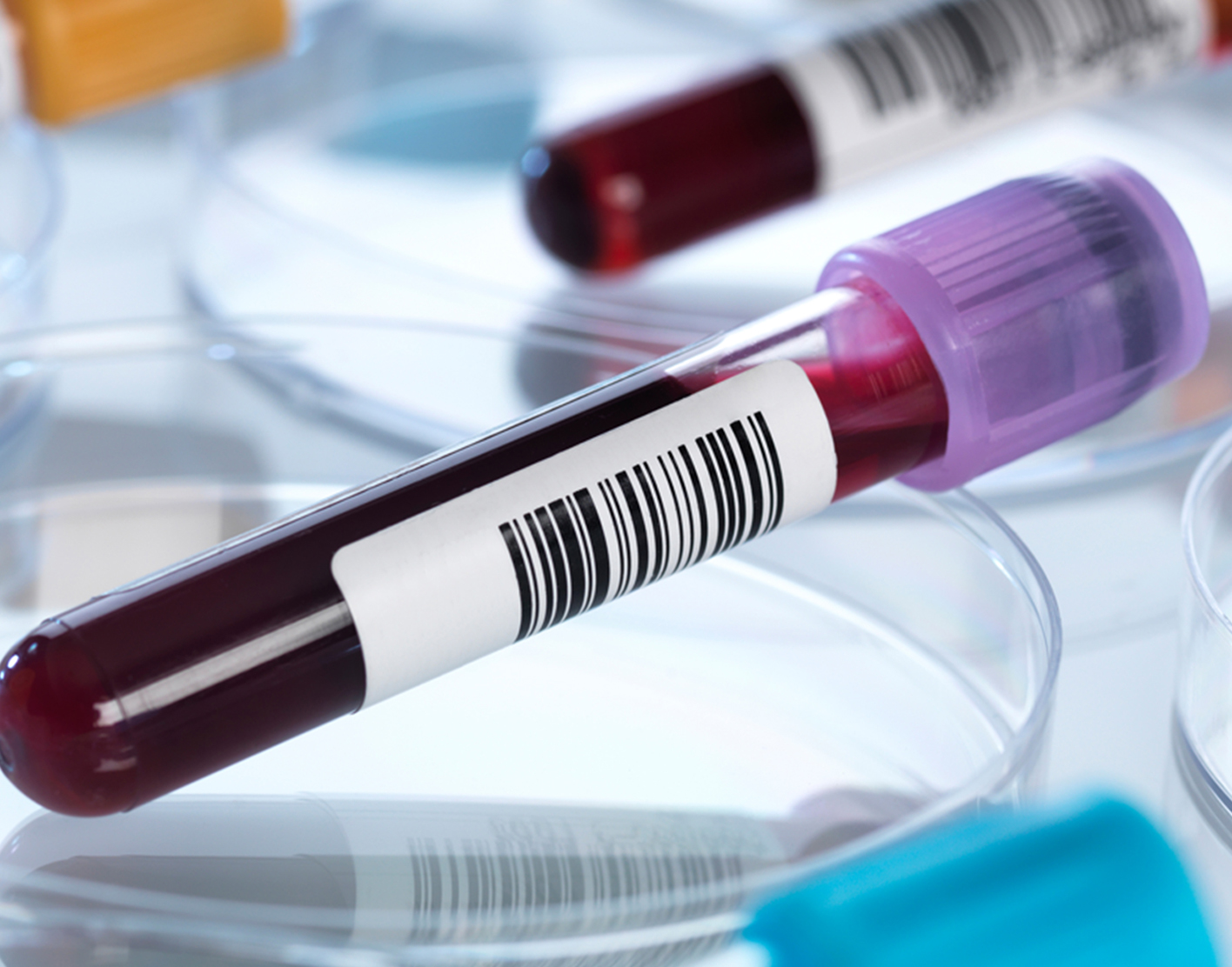 ceruloplasmin-blood-test-708x556-2x