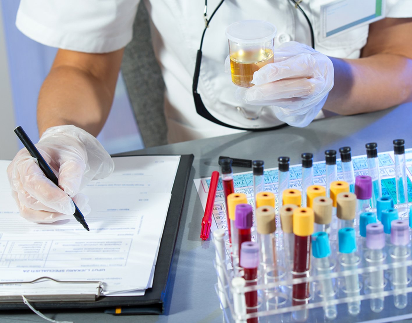 clean-catch-urine-sample-708x556-2x