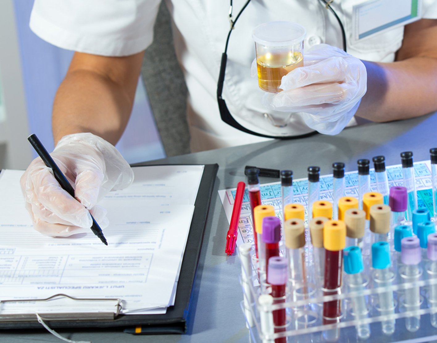 How To Interpret Your Cortisol Urine Test Results