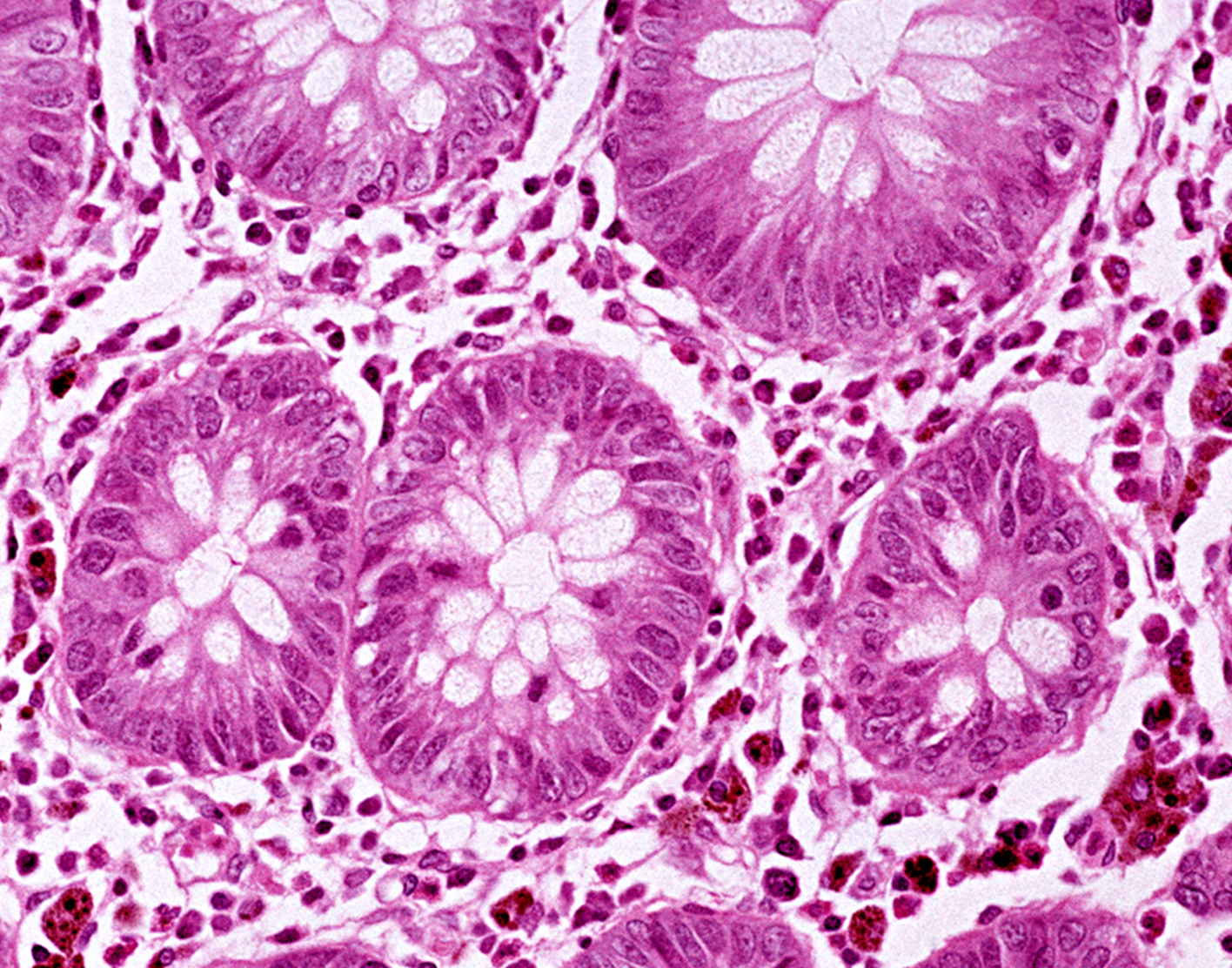 culture-colonic-tissue-708x556-2x