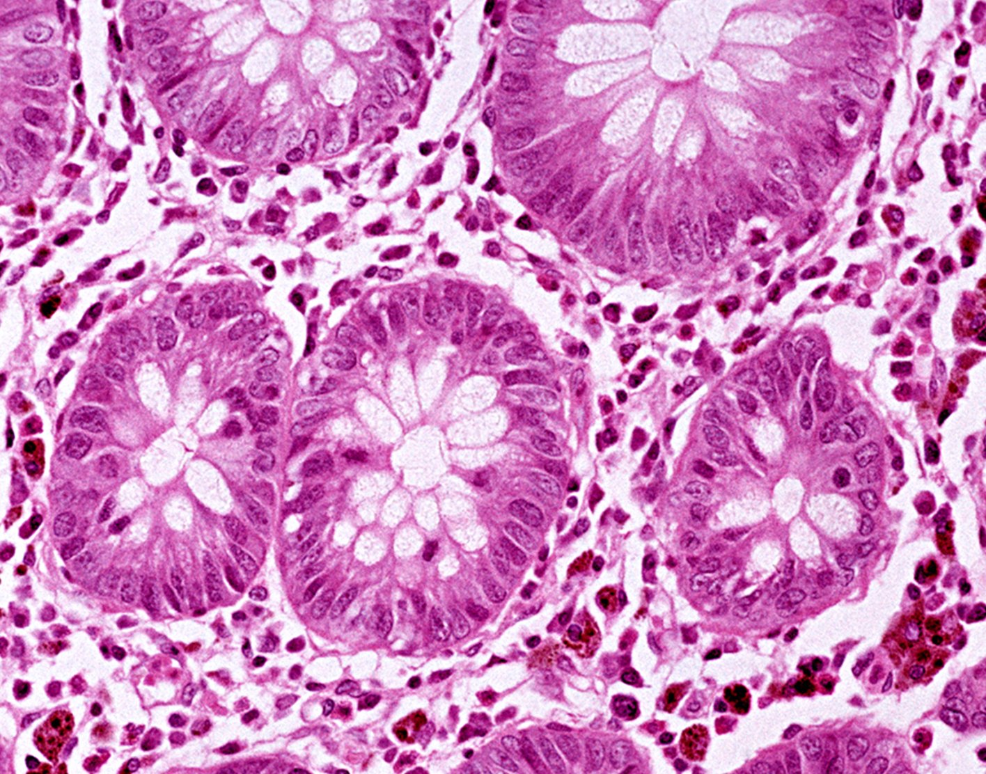 culture-colonic-tissue-708x556-2x