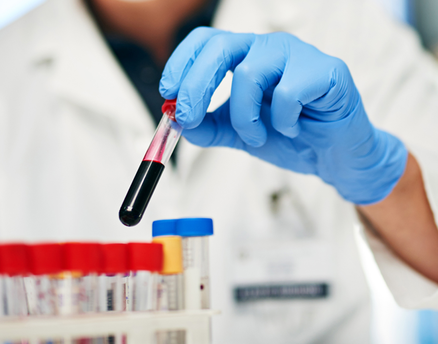 digoxin-test-708x556-2x