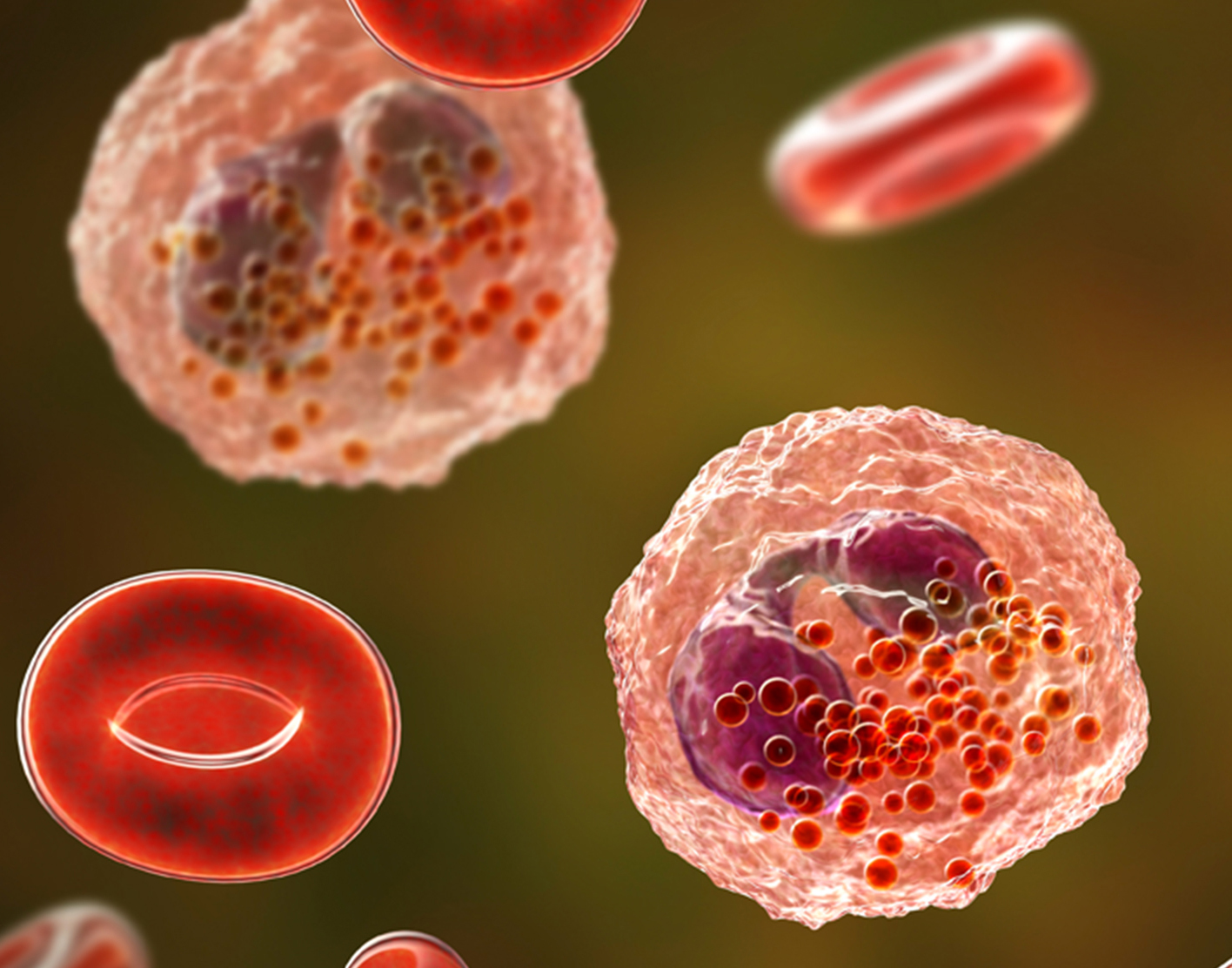 eosinophilic-esophagitis-708x556-2x