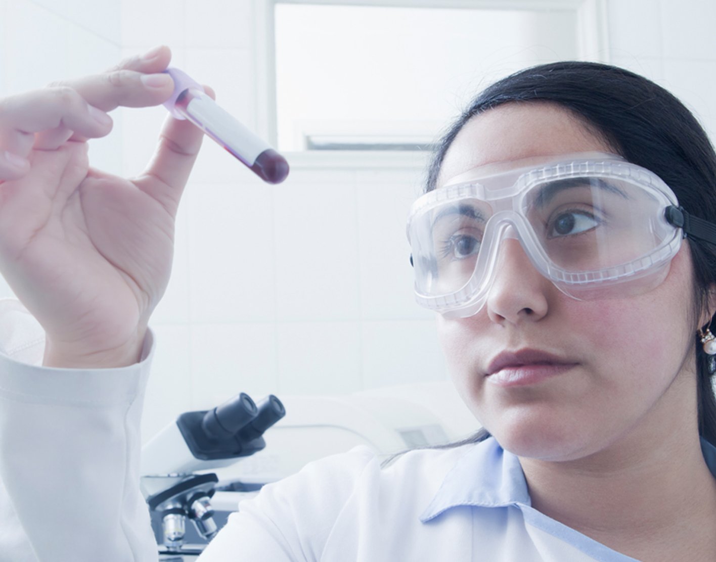 ethylene-glycol-blood-test-708x556-2x