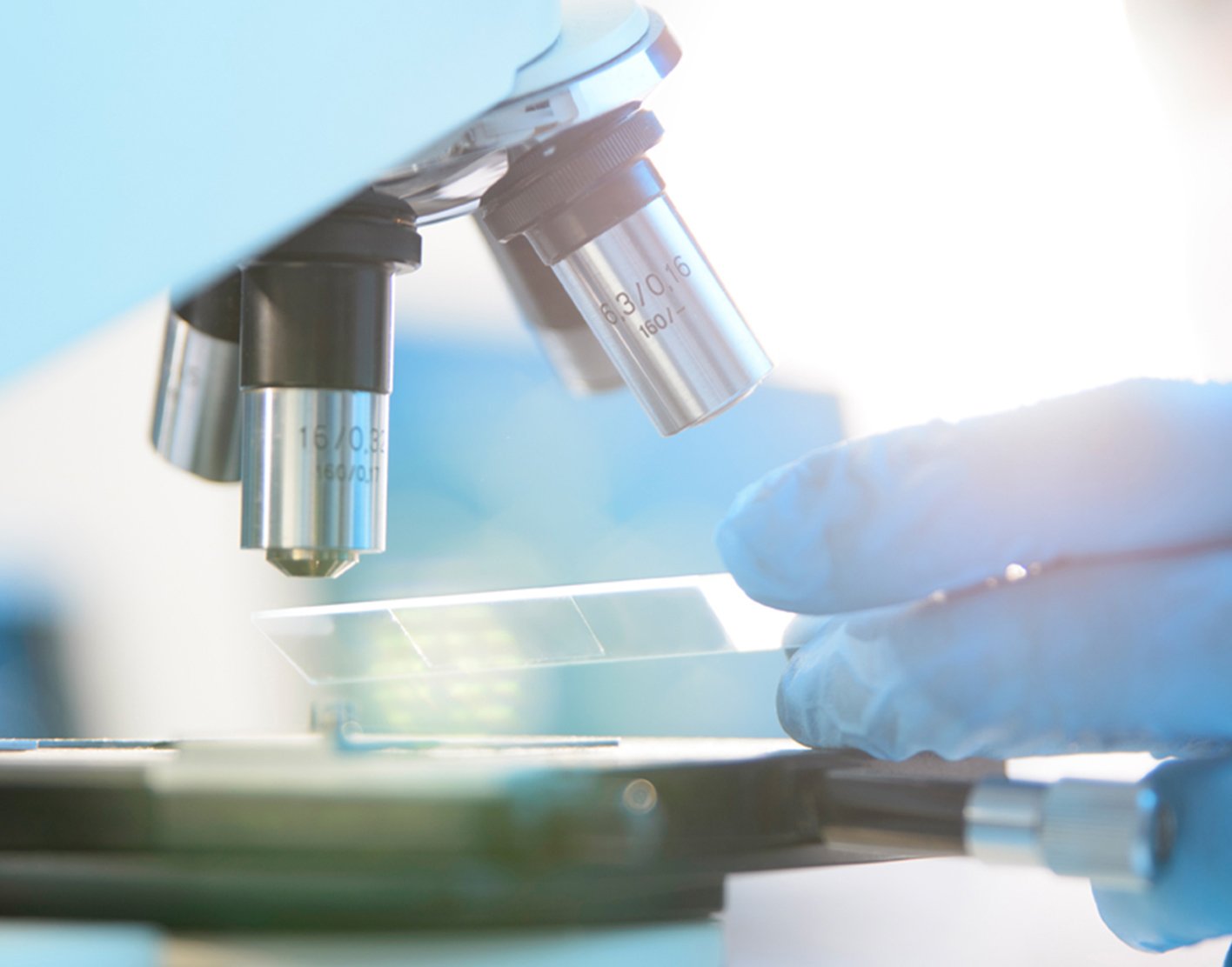 gastric-tissue-biopsy-and-culture-708x556-2x