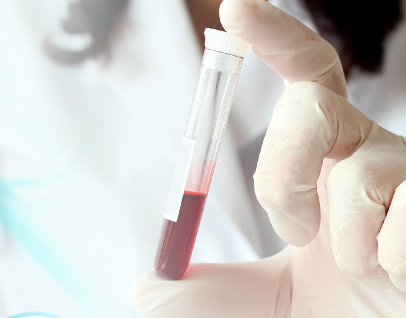 helicobacter-pylori-infection-708x556-2x