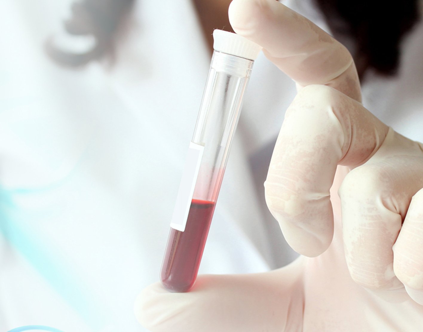 helicobacter-pylori-infection-708x556-2x