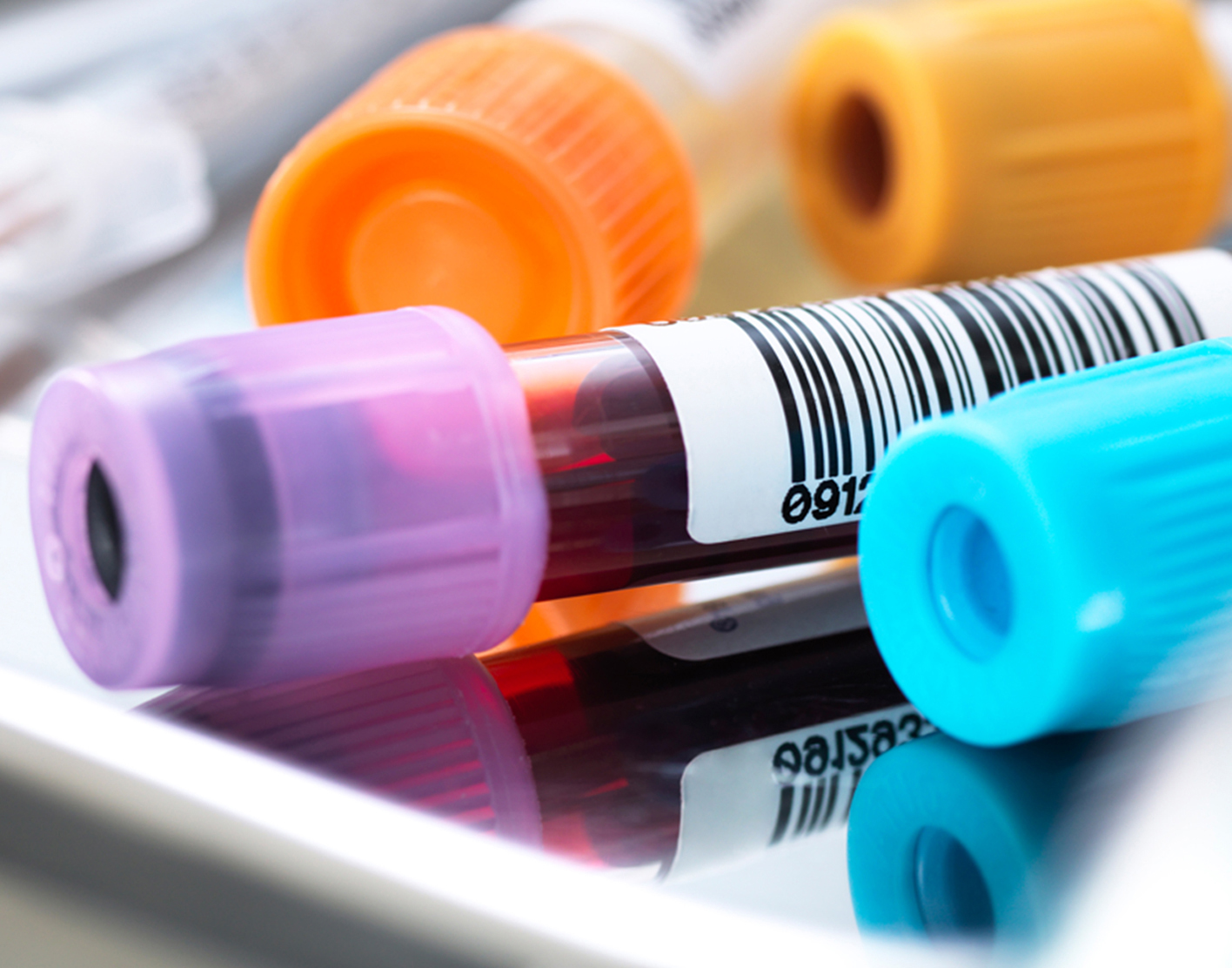 hemoglobin-electrophoresis-708x556-2x