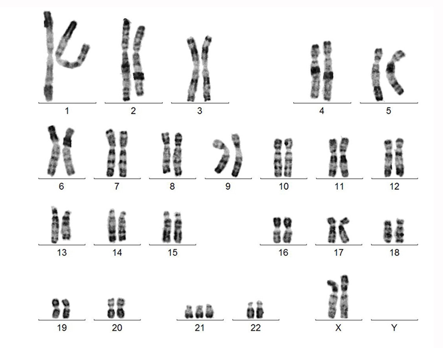 karyotyping-708x556-2x