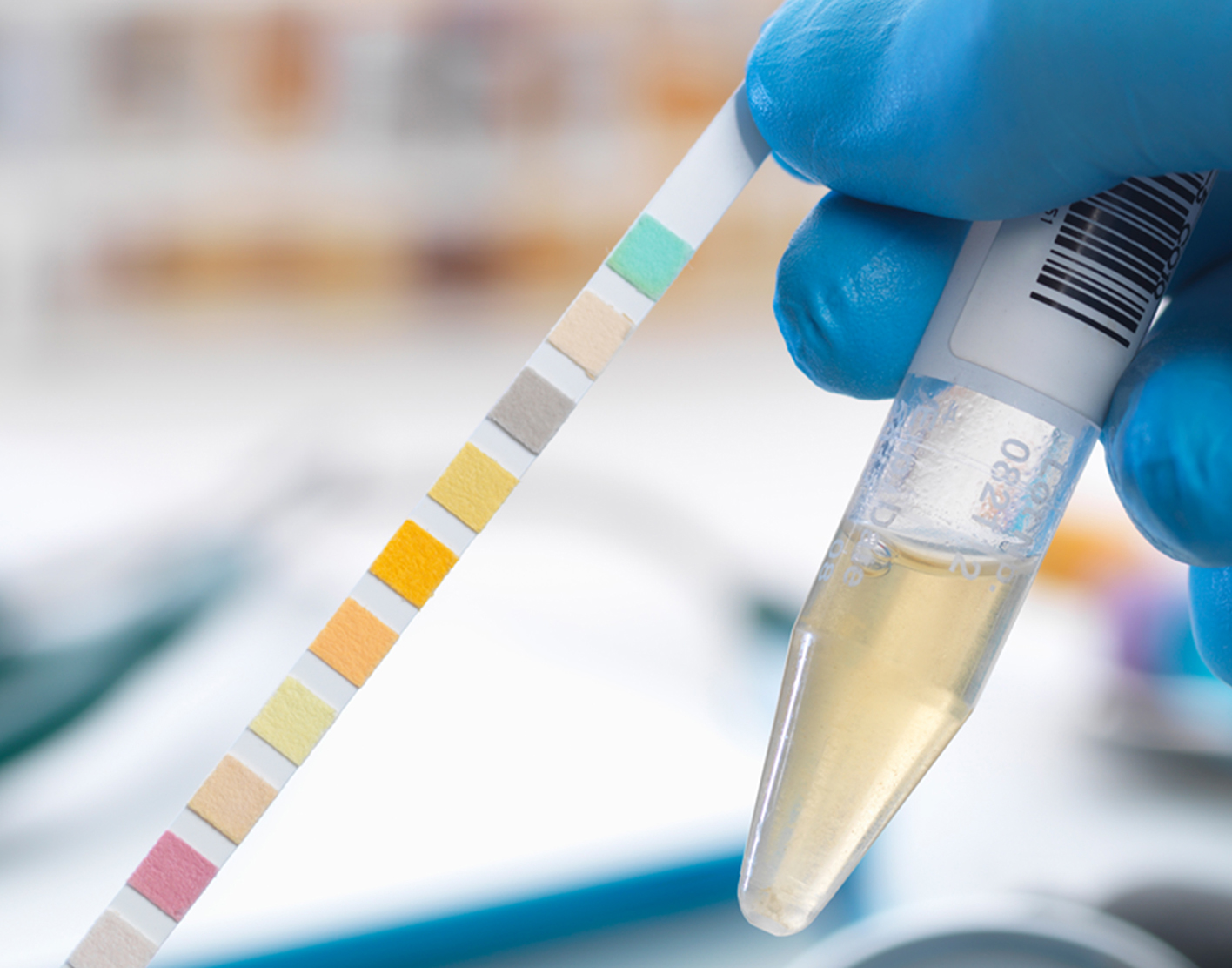 ketones-urine-test-708x556-2x
