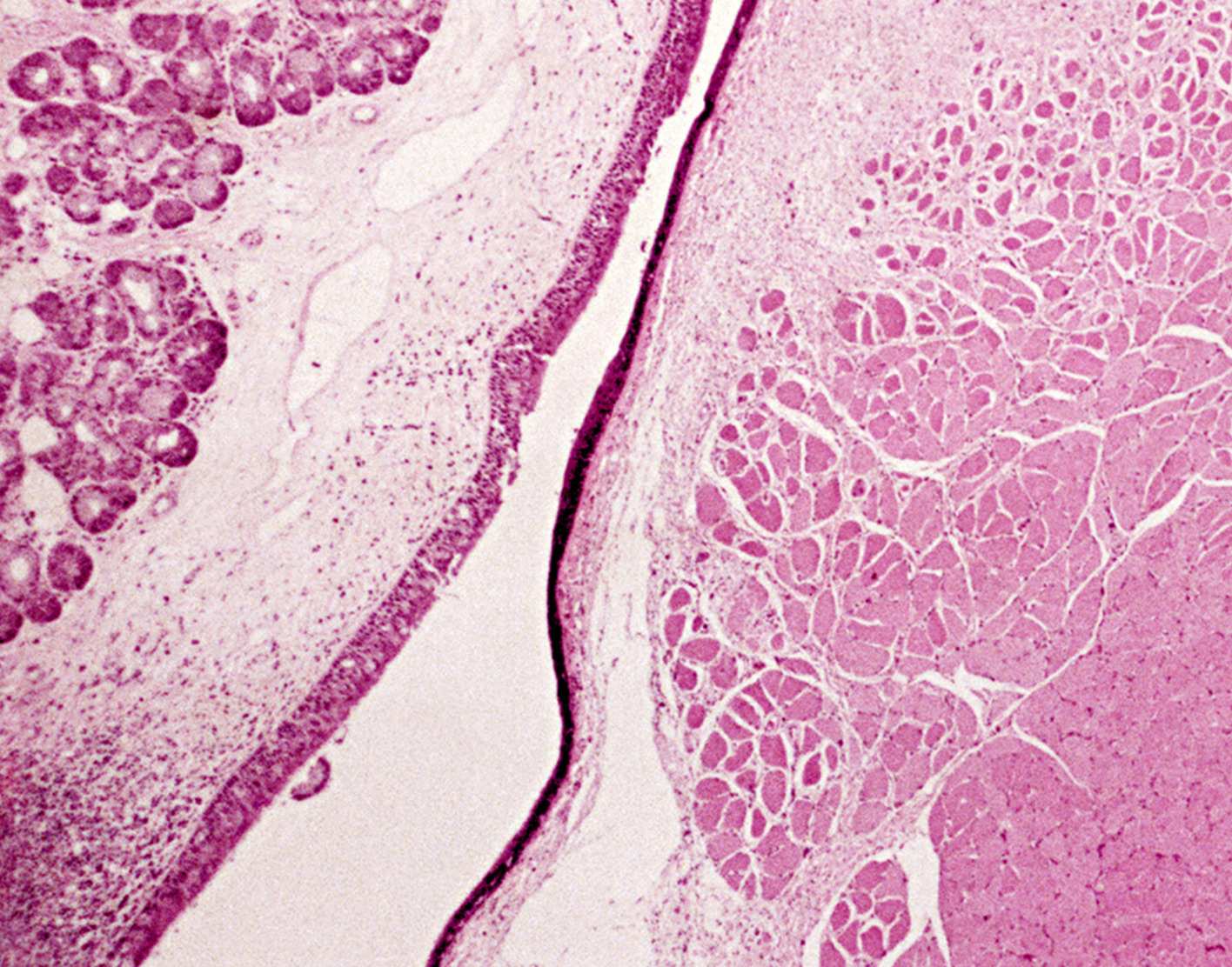 laryngoscopy-708x556-2x