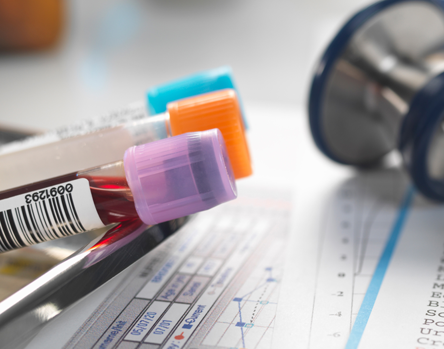 latex-agglutination-test-708x556-2x