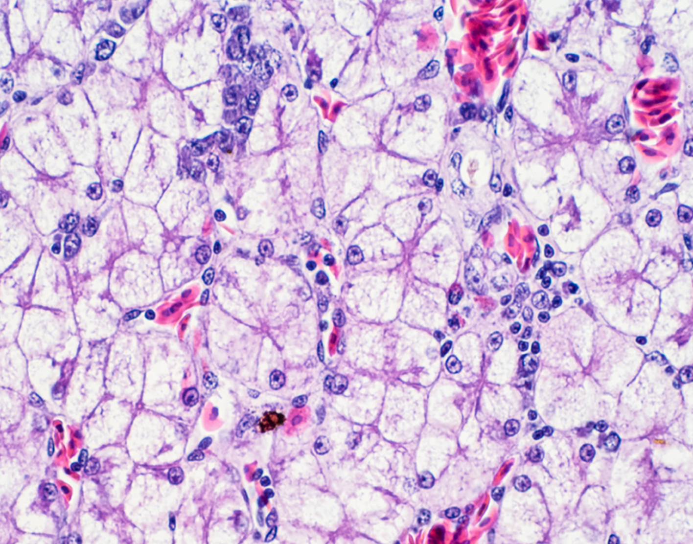 liver-biopsy-708x556-2x