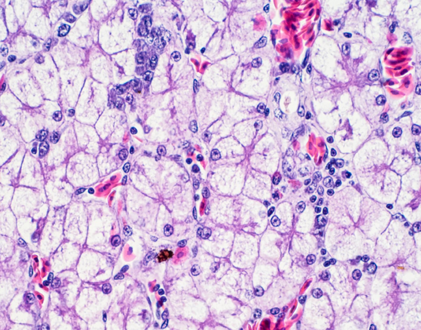 liver-biopsy-708x556-2x
