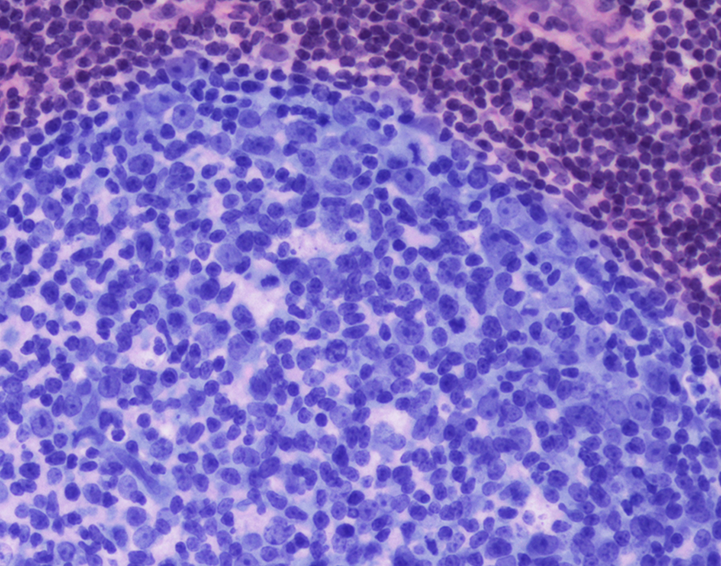 lymph-node-biopsy-708x556-2x