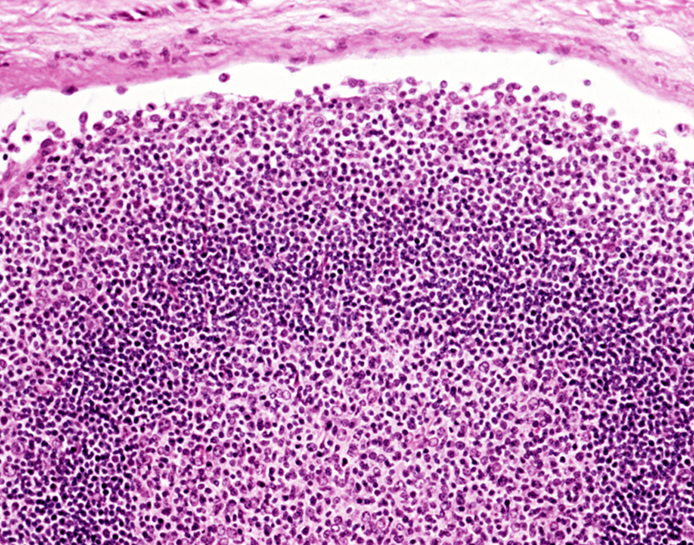 lymph-node-culture-708x556-2x