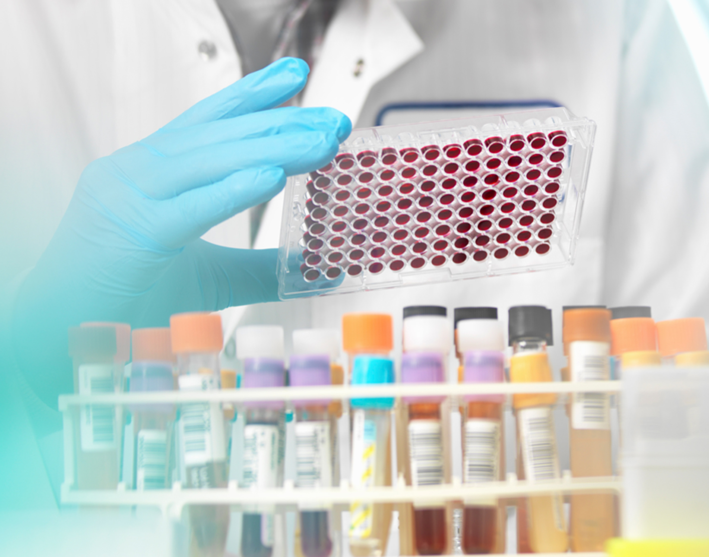 Methylmalonic acid blood test