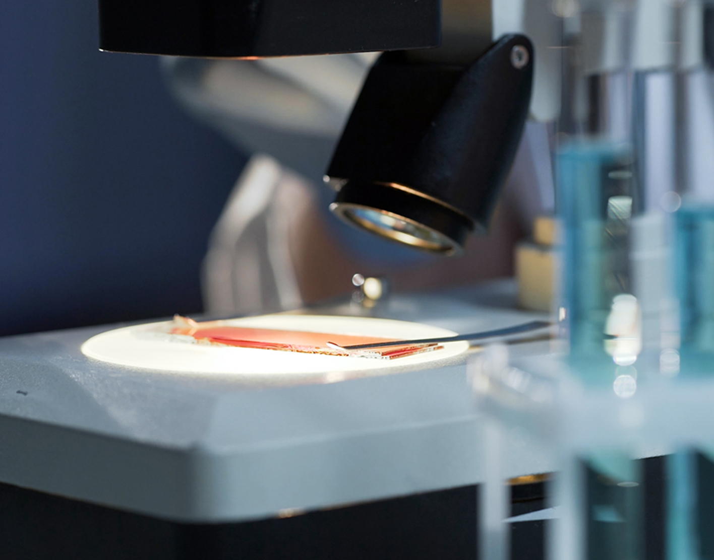 microalbuminuria-test-708x556-2x