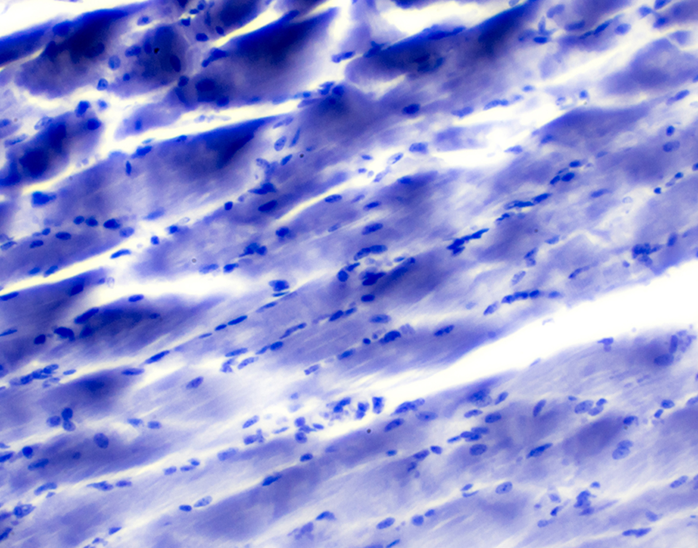 muscle-biopsy-708x556-2x