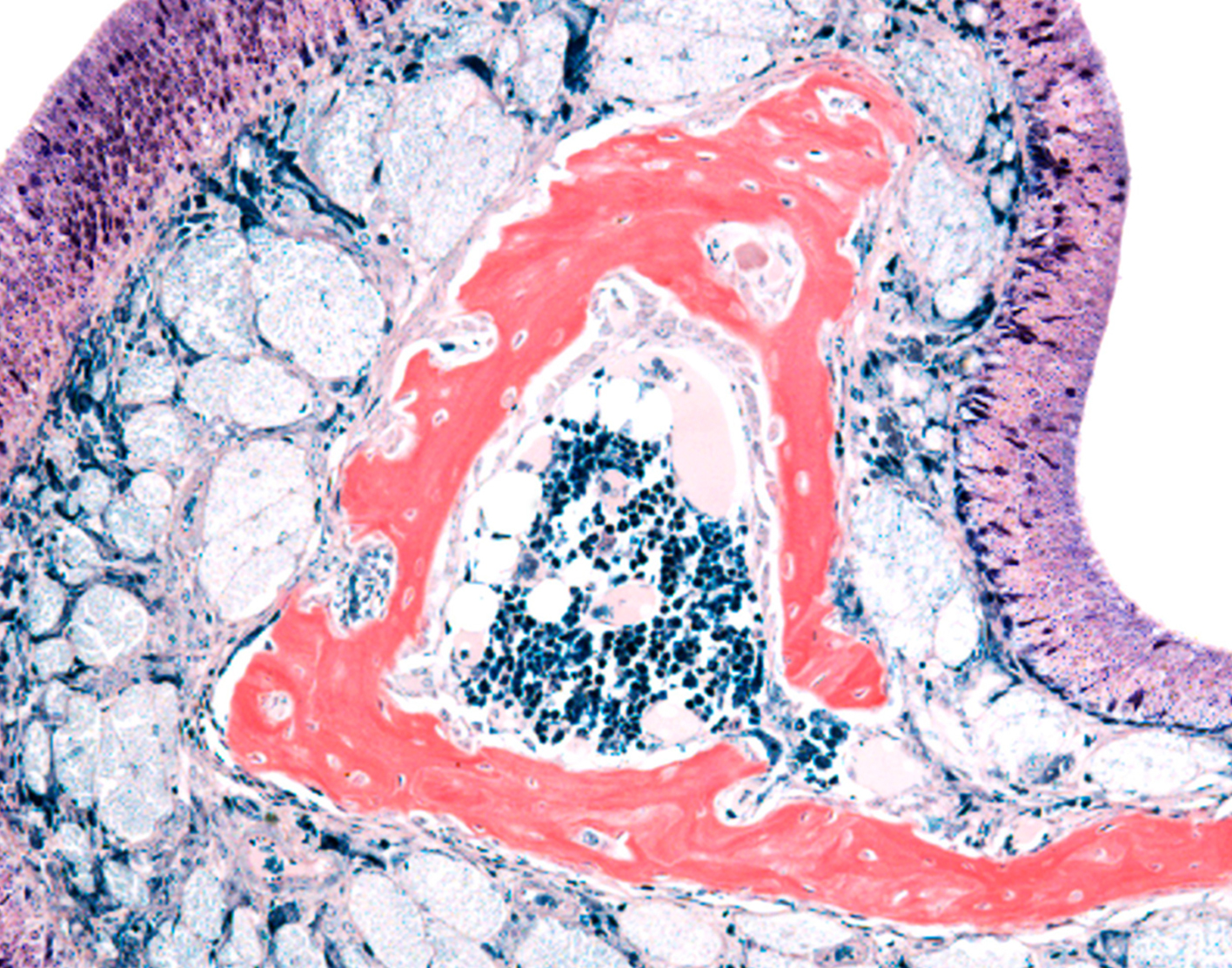 nasal-mucosal-biopsy-708x556-2x