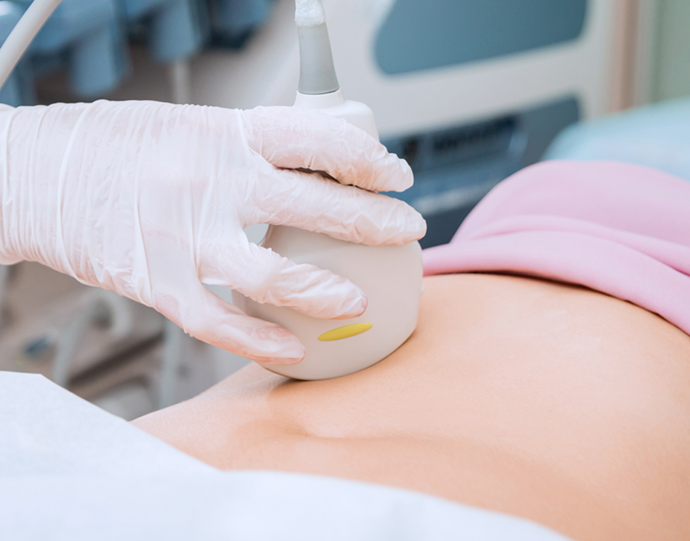 nuchal-translucency-test-708x556-2x