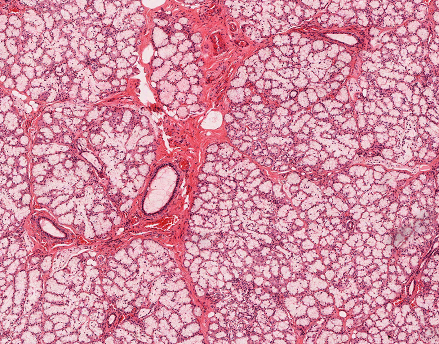 oropharynx-lesion-biopsy-708x556-2x