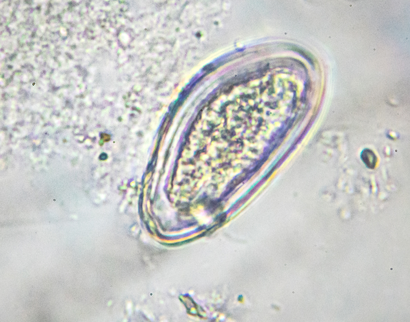 pinworm-test-708x556-2x