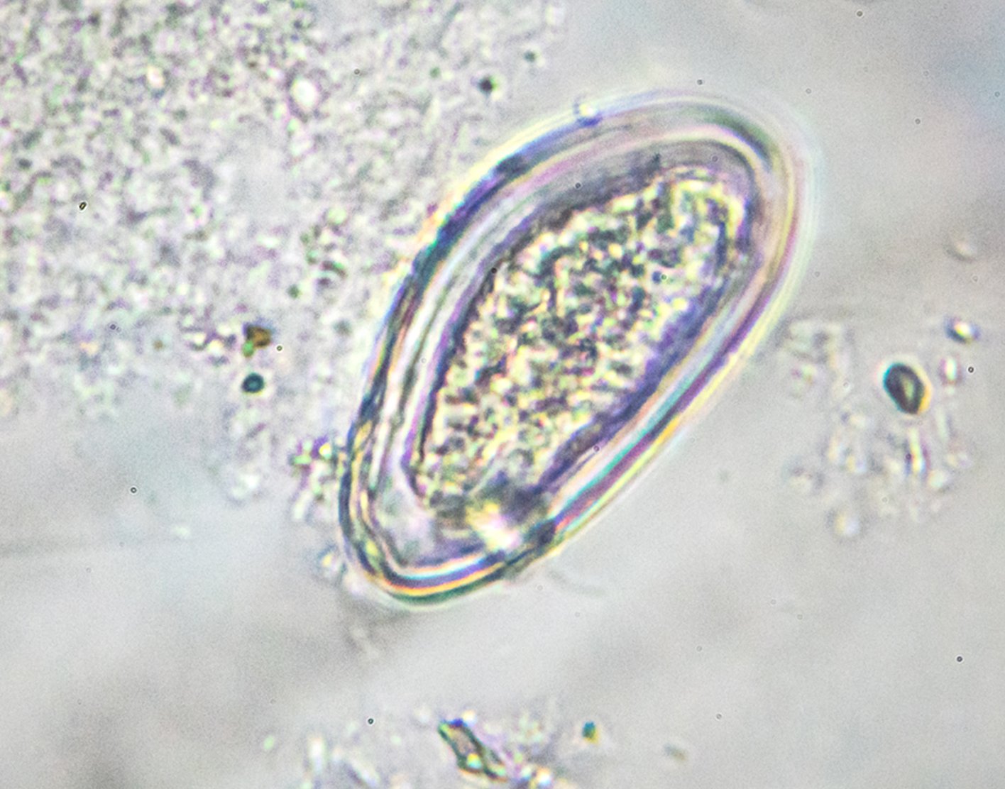 pinworm-test-708x556-2x