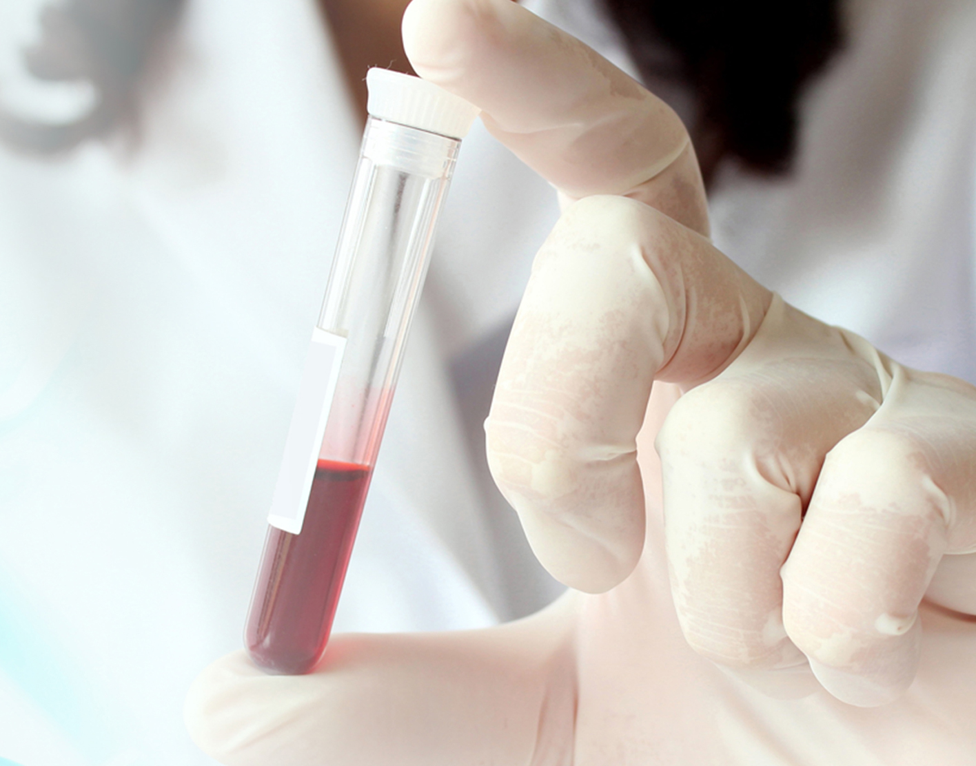 platelet-aggregation-test-708x556-2x