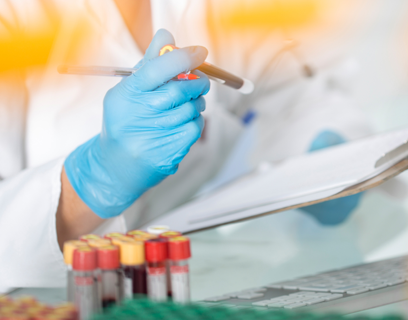 porphyrins-blood-test-708x556-2x