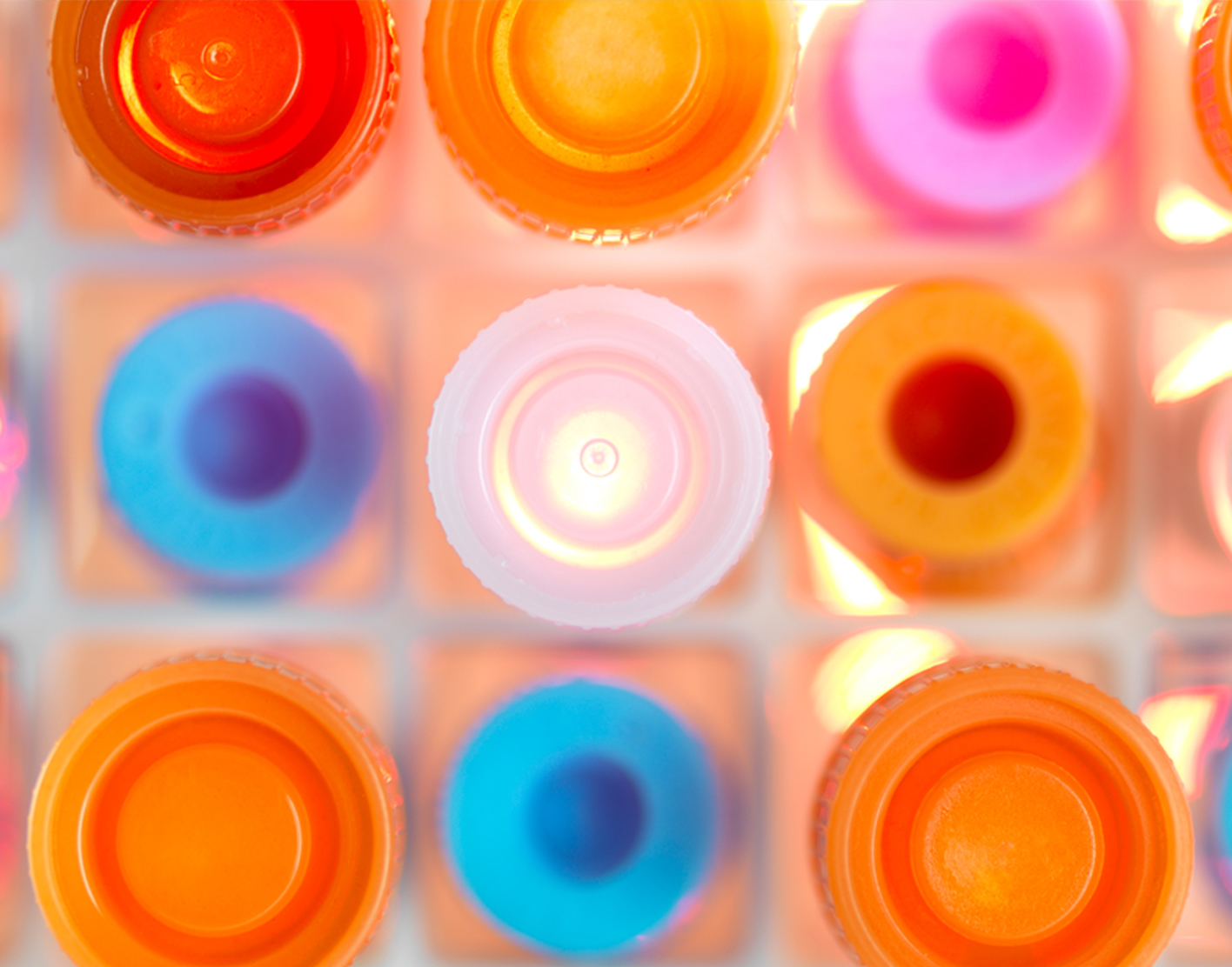 Porphyrins urine test