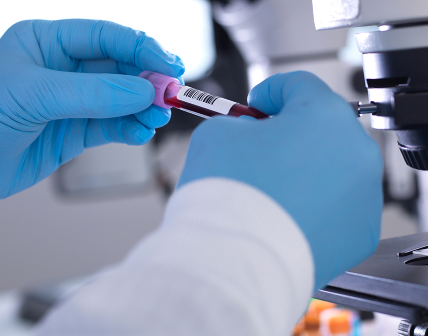 prostate-specific-antigen-psa-blood-test-708x556-2x