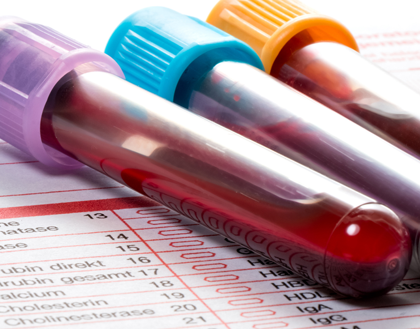 proteinsbloodtest708x5562x